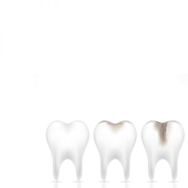 Лечение и профилактика зубов. Хорошая стоматология